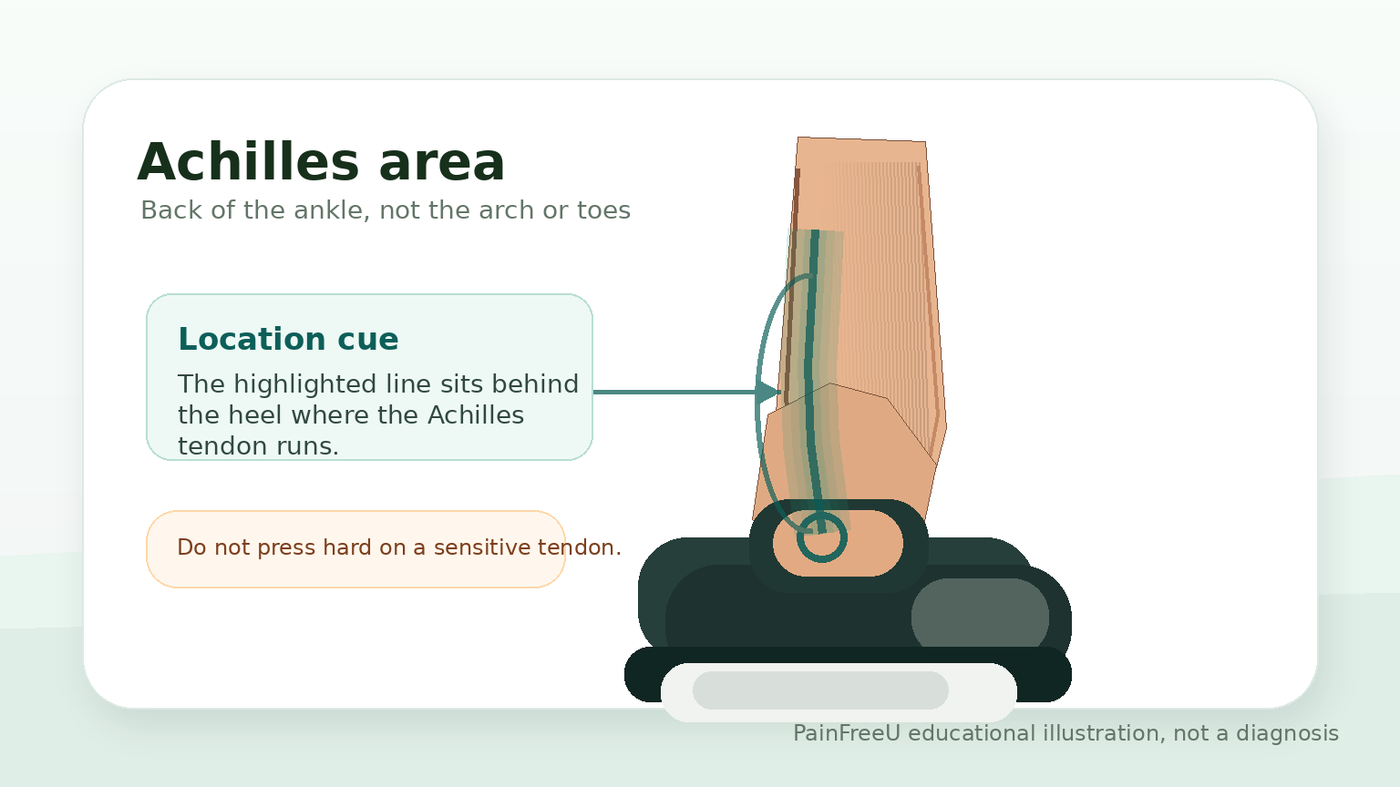 PainFreeU illustration showing the Achilles tendon area behind the heel, not the arch or toes.